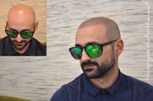 micropigmentation naturelle