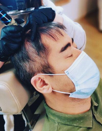 Réalisation d'une densité homme par Alexandra au Centre-micropigmentation de Belgrade en région Namuroise.