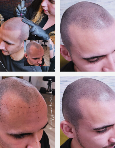 micropigmentation effet rasé, déroulement de la construction sur 4 sessions au centre micropigmentation de Belgrade en région Namuroise. anciennement tricopigmentation hainaut.