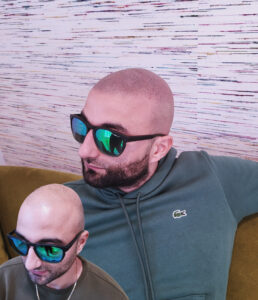 Avant / après d'un effet rasé homme réalisé au centre micropigmentation hainaut